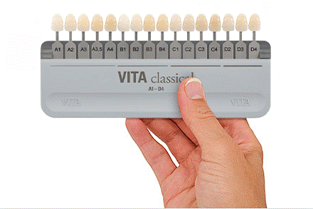VITA Shade Guide